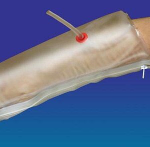 Inflatable Air Splint Half-Arm 25